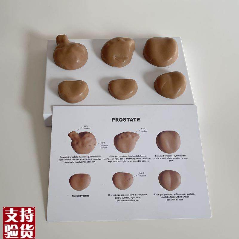 前列腺触诊练习临床辅检健康x与病变指检男科生殖医患沟通医药促