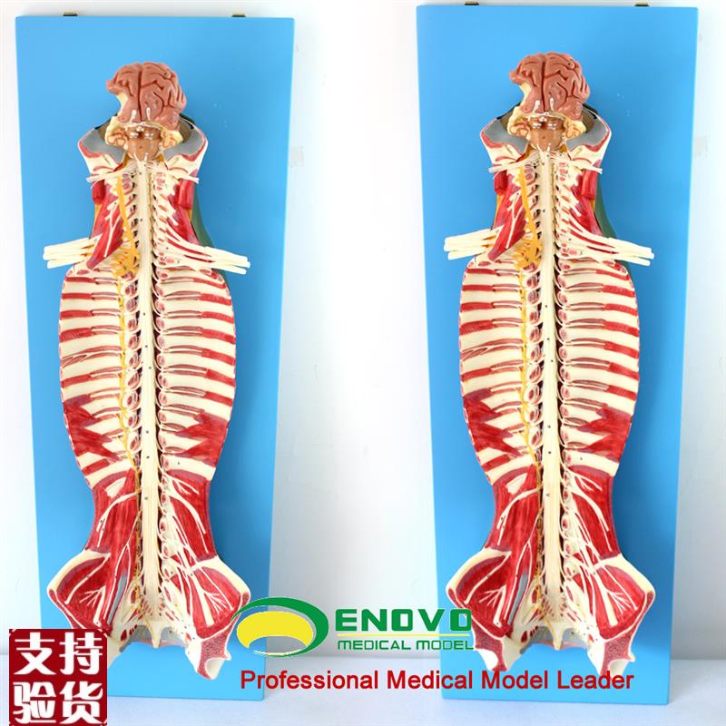 ENOVO颐诺医学人体r脊柱椎管解剖脊髓神经麻醉脊腰椎微创骨科模型