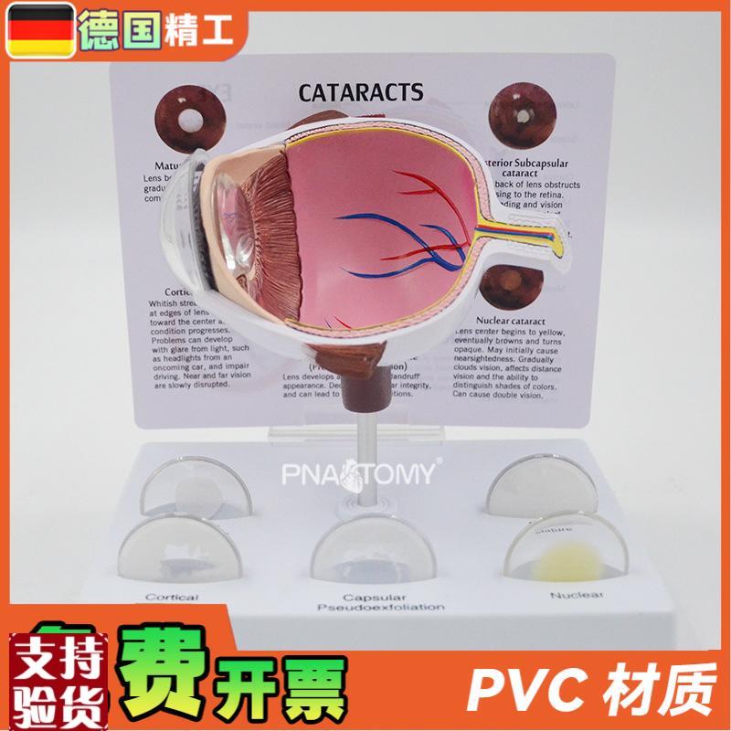 德国】眼球模型病理眼球演示教具眼科展示礼品Q人体器官解剖模型
