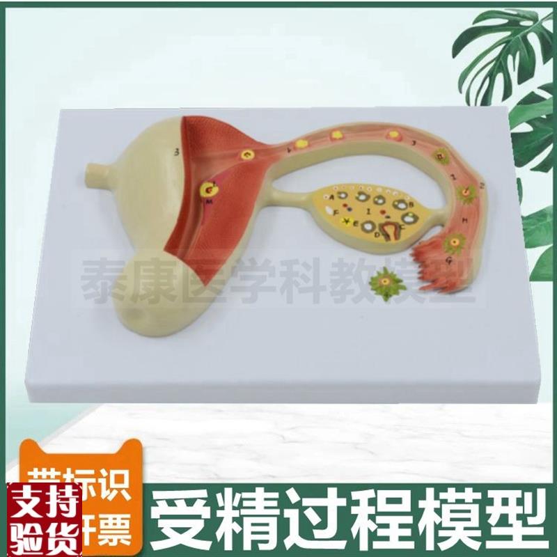 受精过程模型精子和卵子结合生殖胚胎妊娠发育过T程妇产科教学用