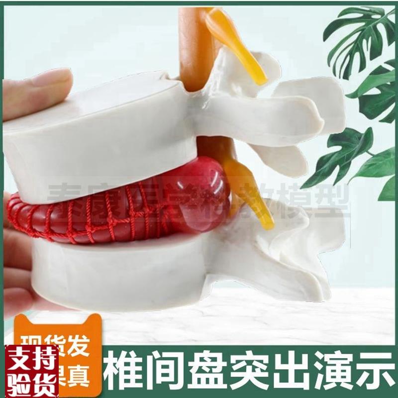 椎间盘压迫神经演示模型突出脊骨劳损骨质密度变S化疏松变脆老年