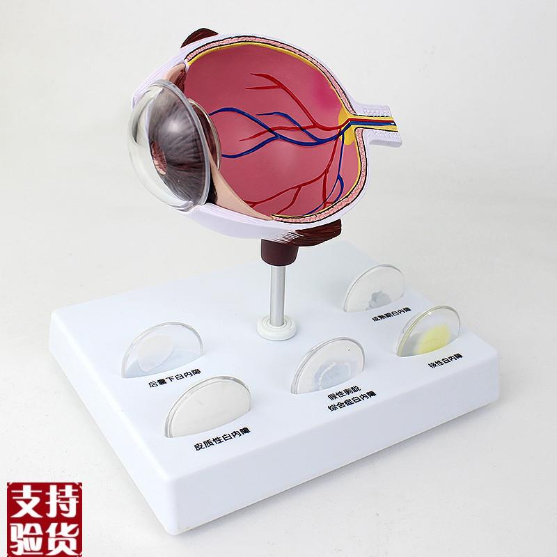 ENOVO颐f诺人体眼球白内障眼疾病瞳孔眼球体眼珠晶体医学教具白内