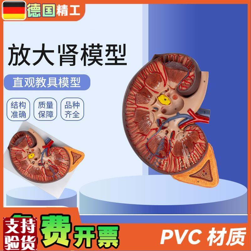 德国】放大肾模i型肾解剖附人体医学解剖模型教学培训肾上腺放大