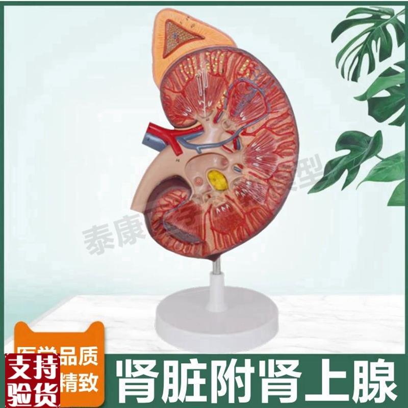 人体肾脏模型肾上腺放大审单位肾小E球蛋白尿形成尿液泌尿器官病