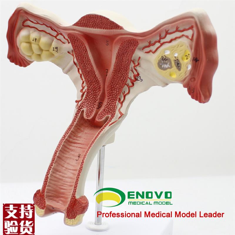 颐诺正品人体医j用女性子宫模型卵巢生殖结构解剖模型妇科妇产科