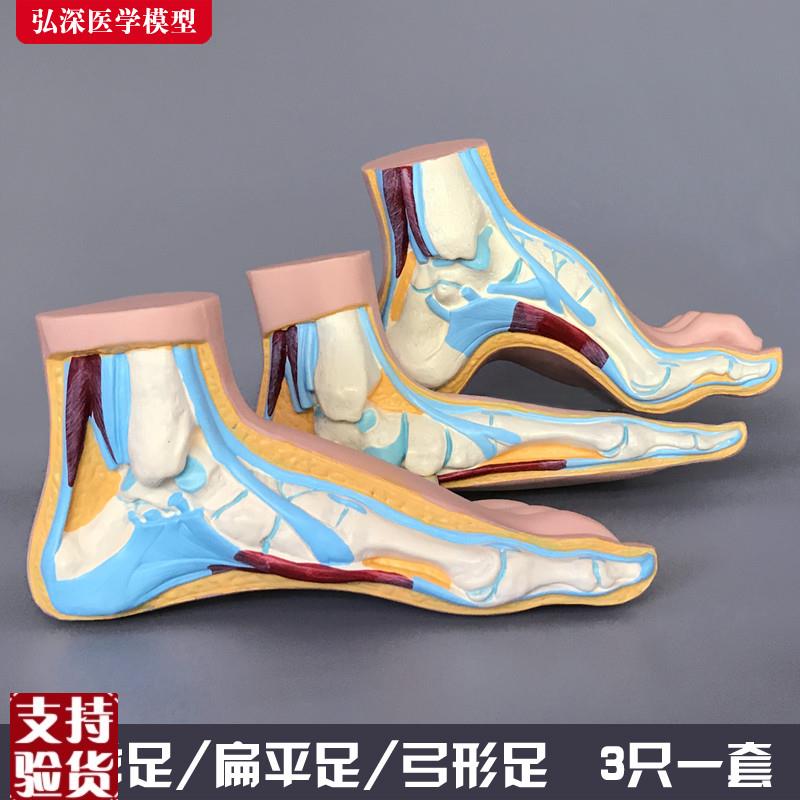 脚模型正常足扁平足弓型足解剖人B体脚部构结构造肌肉血管医学模