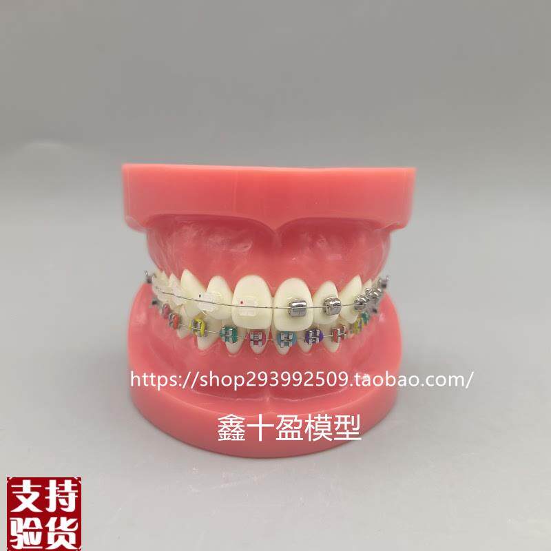牙科正畸模型球形金属自锁托槽正畸模型矫正练习W模型医患沟通