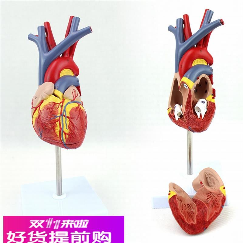 ENOVO颐诺人体心脏模型医学心血管内科心脏介入解剖教学冠状动脉