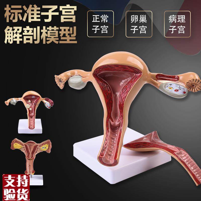 人体模型女性生殖子宫模型医院用病变H子宫模型教具妇科解剖卵巢