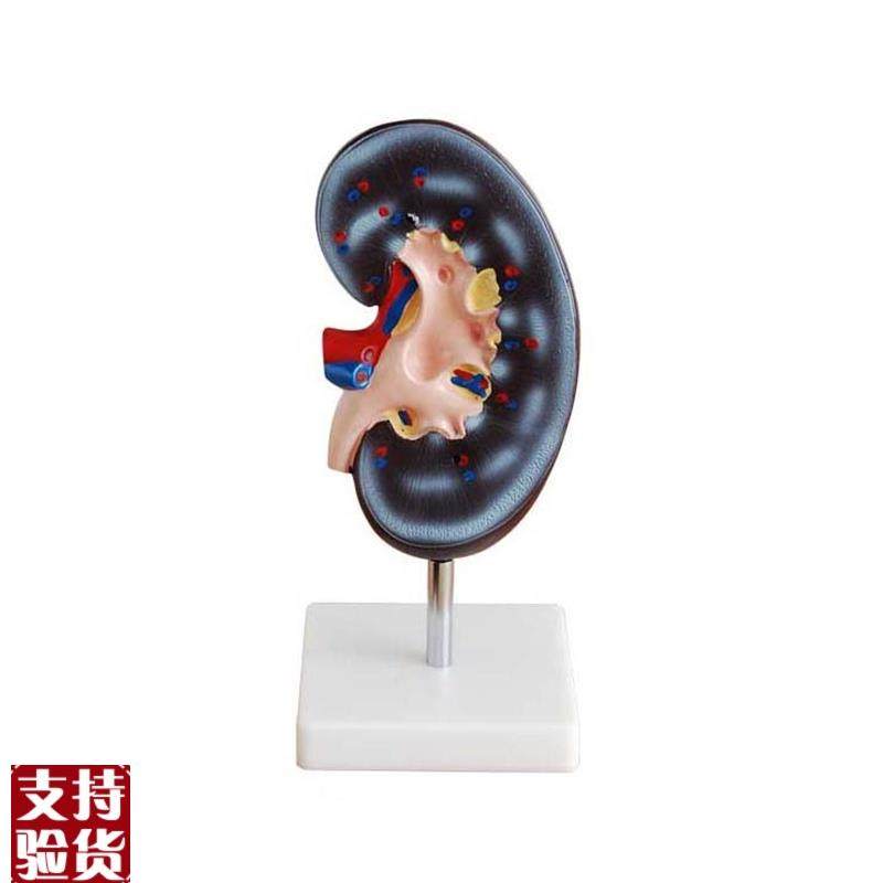 人体肾解剖模型1件肾解剖展I示模型人体肾展示模型