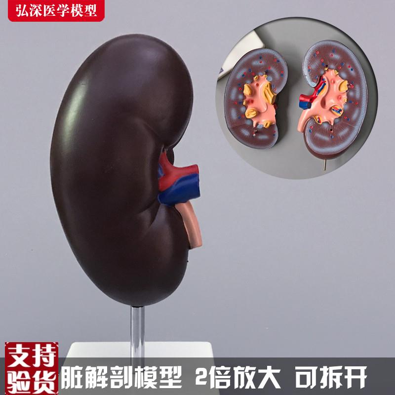 肾解剖模型人体肾脏结构切面y泌尿系统内脏器官医学教学模具玩具