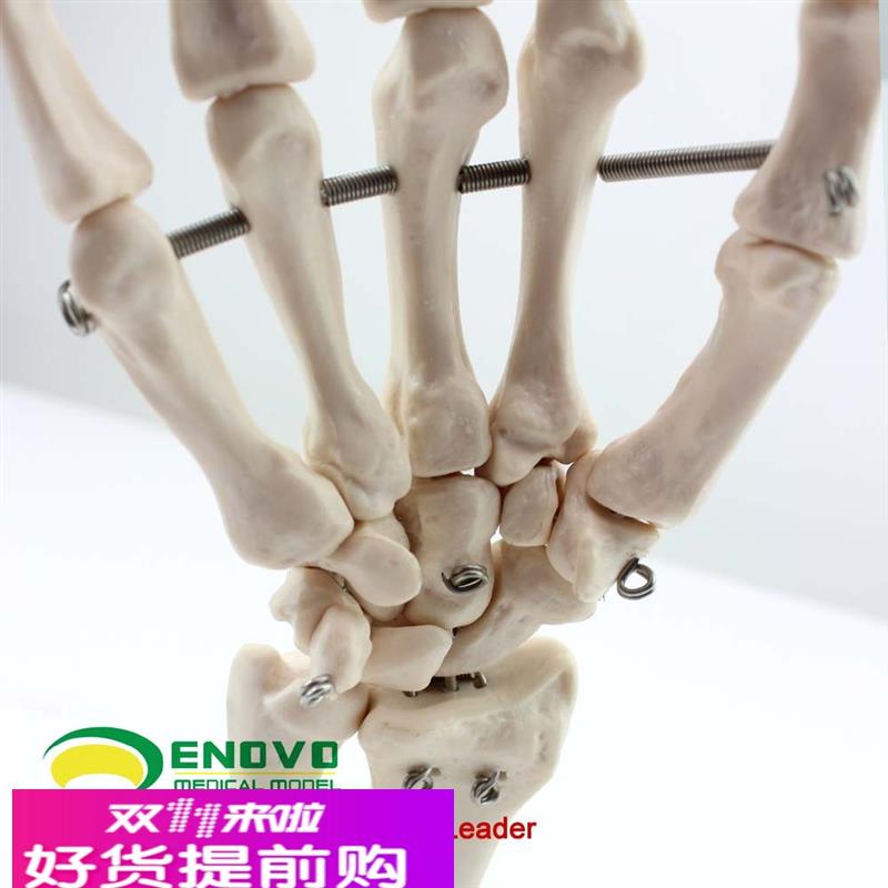 ENOVO颐诺医学人体手关节模型手骨尺骨桡骨模型人体骨骼手足外科
