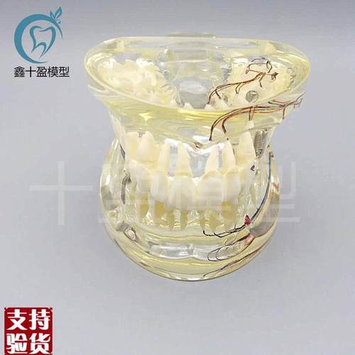 牙科水晶牙齿病理模型nM4019-2成人透明病理牙模型带牙神经和嵌体
