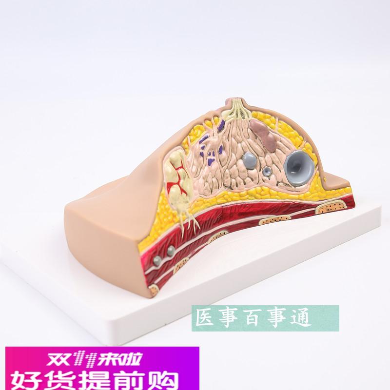 人体1:1乳房模型乳腺解剖女性生殖科普教育教学健康 厂家直销包邮