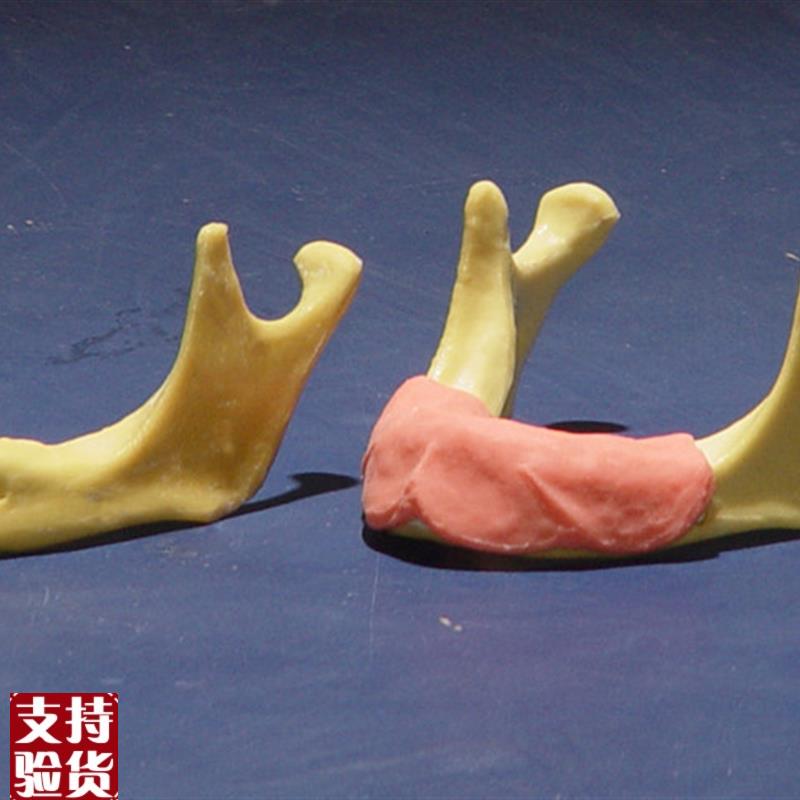 ENOVO颐诺h下颌骨种植操作模型口腔种植口腔齿科培训实训操作模