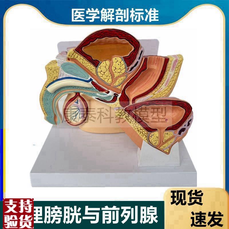 男性前列腺模型健康病变增大肥男科医患桌上型盆腔U病理膀胱泌尿