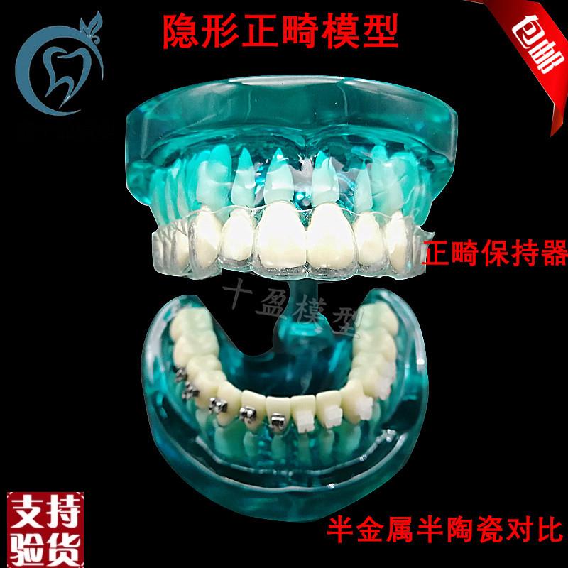 牙科隐形正畸模型正畸保持器示范正畸半金属半陶瓷托Y槽对比包邮