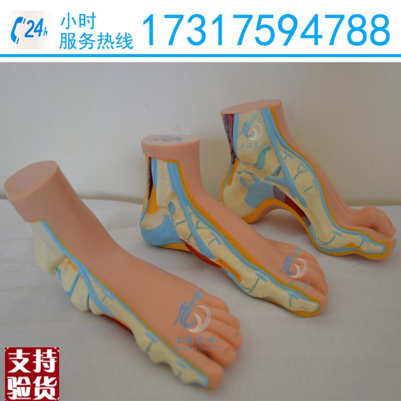 正常足扁平足P弓型足模型