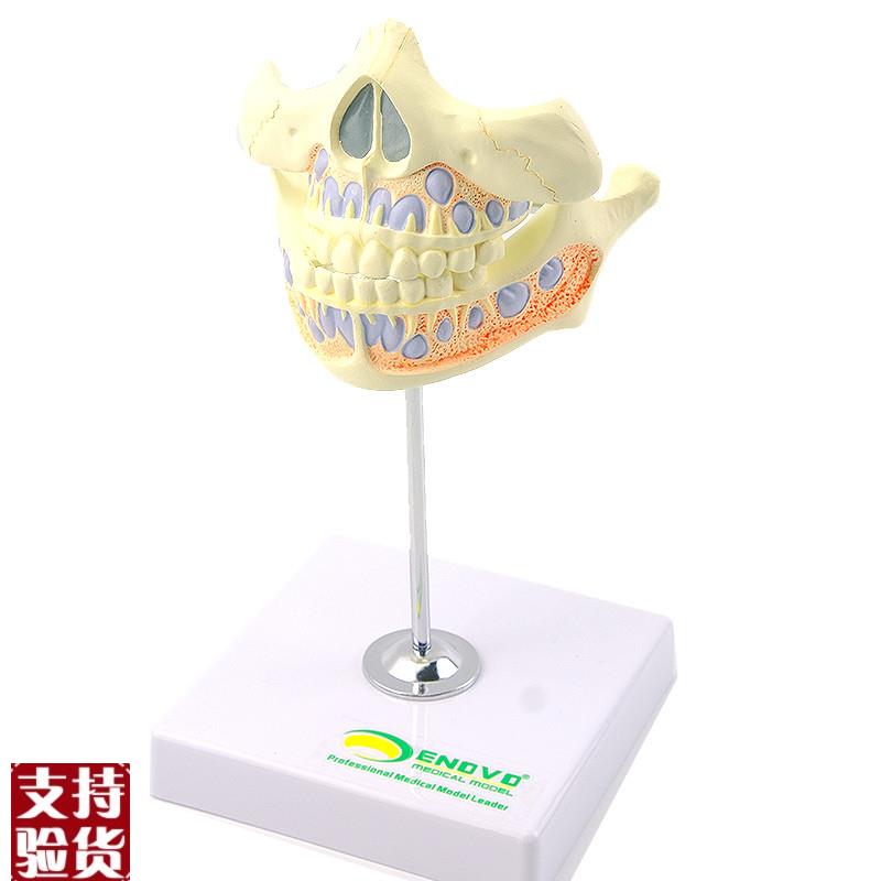 ENOVO颐诺乳牙牙列模型儿y童口腔齿科牙医培训教学医生教具乳牙