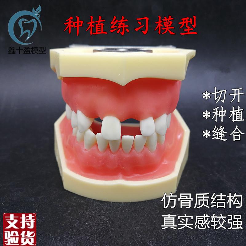 牙科种植c上下缺失练习切开种植缝合仿骨质牙齿模型上颌窦提升术