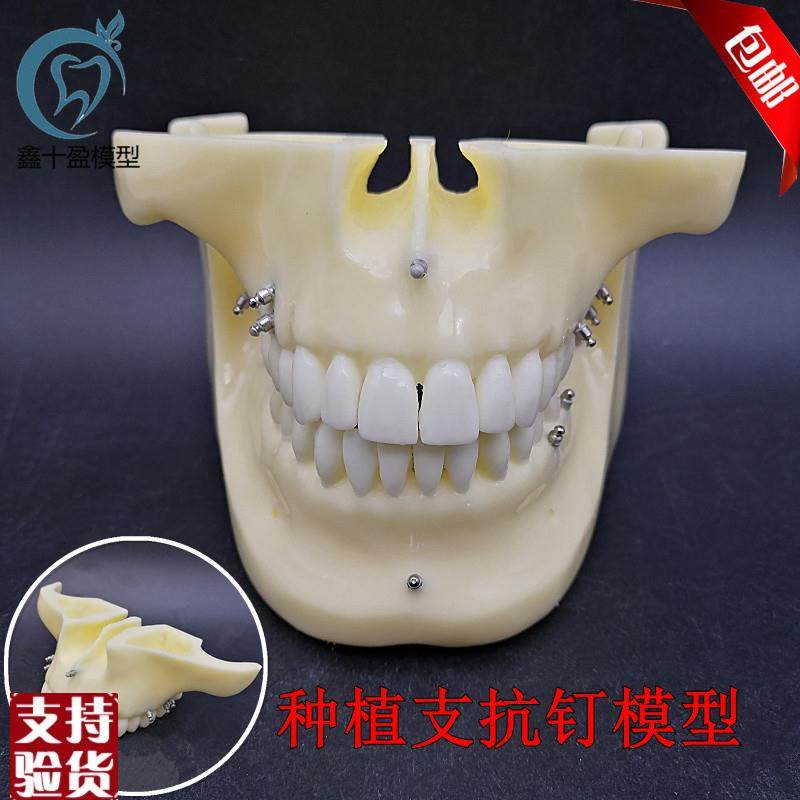 牙科种植支抗钉模型练习种植模型牙科教学模型口X腔教学示分解,美容美体仪器,口腔护理设备礼盒,淘宝优惠券,粉丝福利购,淘宝优惠卷