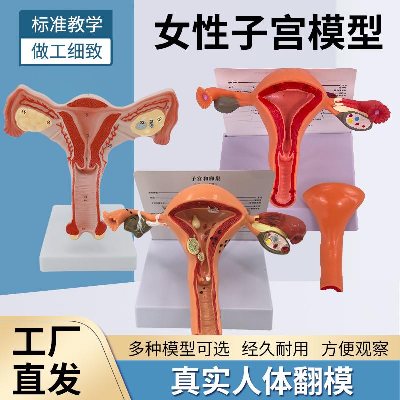 人体女性生殖子宫解剖病理模型阴道卵巢教学模R型妇科生殖科教具