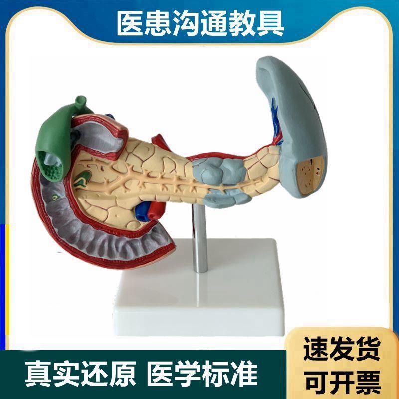 病理胆囊模型十二指肠胰腺脾脏人体消L化器官模型医药促销用
