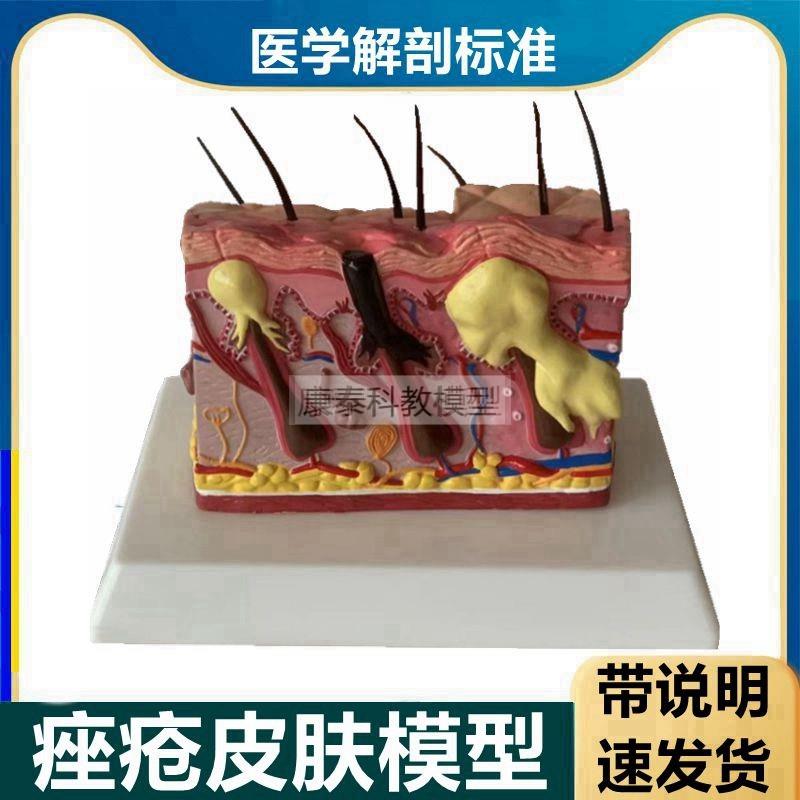 人体痤疮皮肤模型l毛发皮下血管神经毛囊美容微整形螨虫叮咬病理