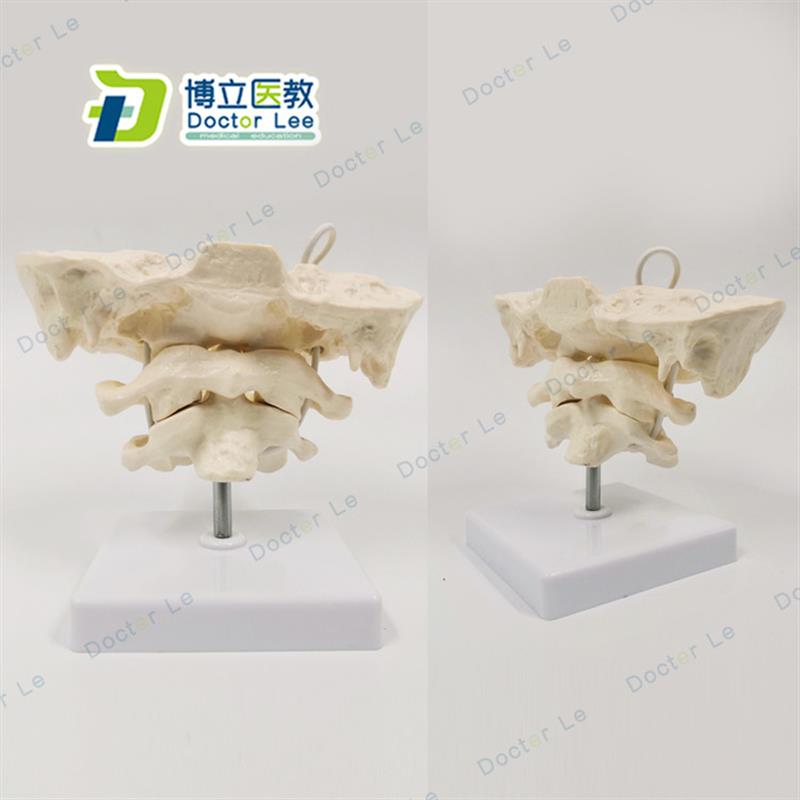 后枕骨颈椎带颈动脉椎间盘与神经教学K模型,腰椎骨骼架模型
