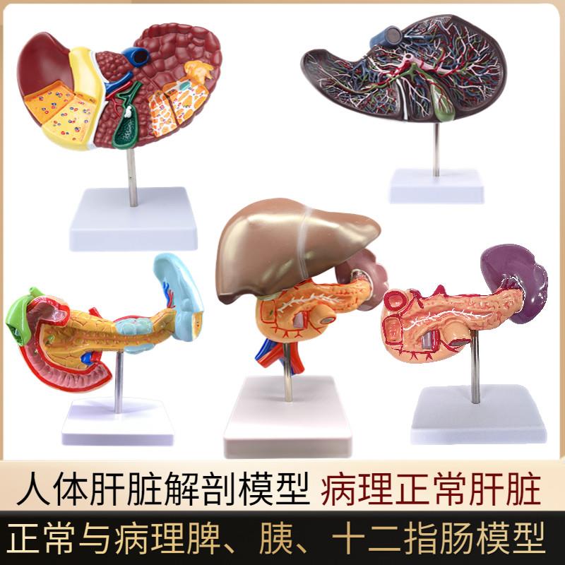 人体肝脏模型肝解剖模型肝t胆胰脾十二指肠病变肝胆胰胆囊消化内
