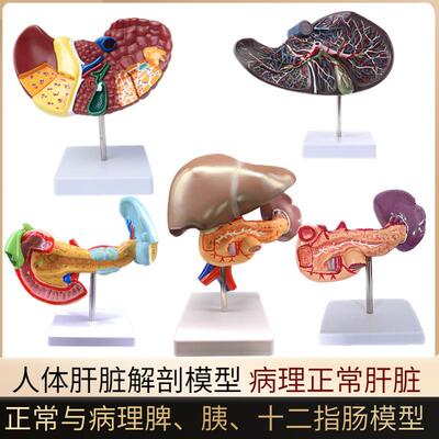 人体肝脏模型肝解剖模型肝t胆胰脾十二指肠病变肝胆胰胆囊消化内