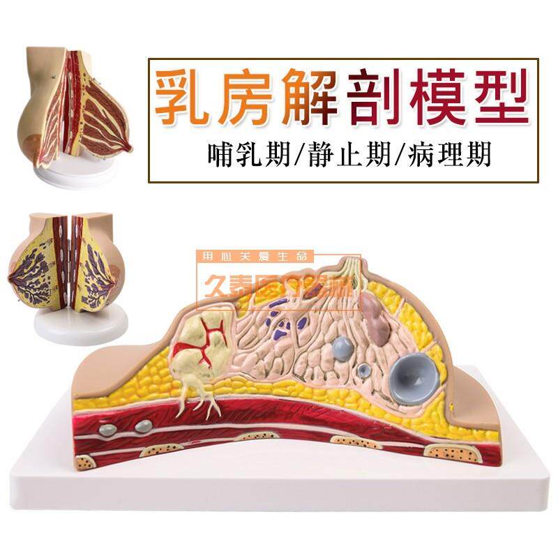 乳房病理模d型乳房病变模型乳房模型乳房解剖模型哺乳培训模型