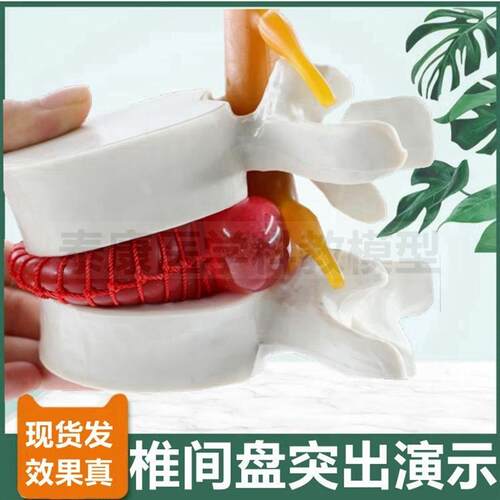 椎间盘压迫神经演示模型突出脊骨劳损骨I质密度变化疏松变脆老年