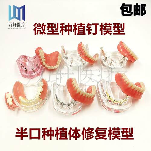 牙科口腔教学模型种植修复对比模型微型种植钉O2颗4颗钉种植球帽