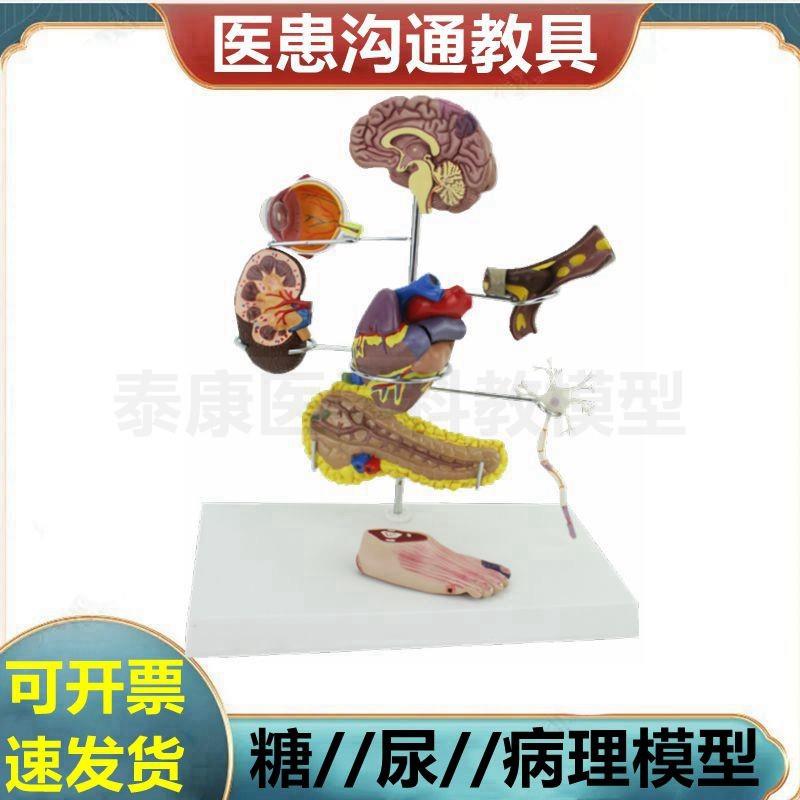 糖尿模型病理器官脑眼睛心血管足肾脏心脏结构S病理粥样冠状阻塞