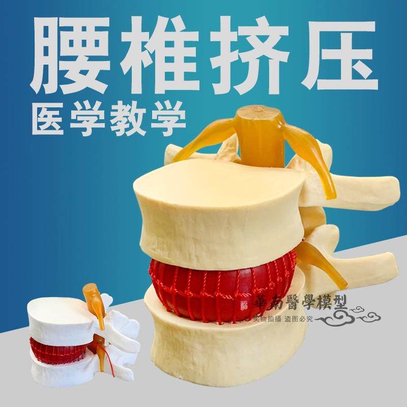 正品医用人体腰椎间盘r演示模型腰椎模型脊柱模型脊椎模型包邮