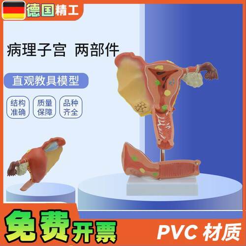 德国】PNT-0743仿真子宫模B型病理子宫输卵管结构病态子宫模型教