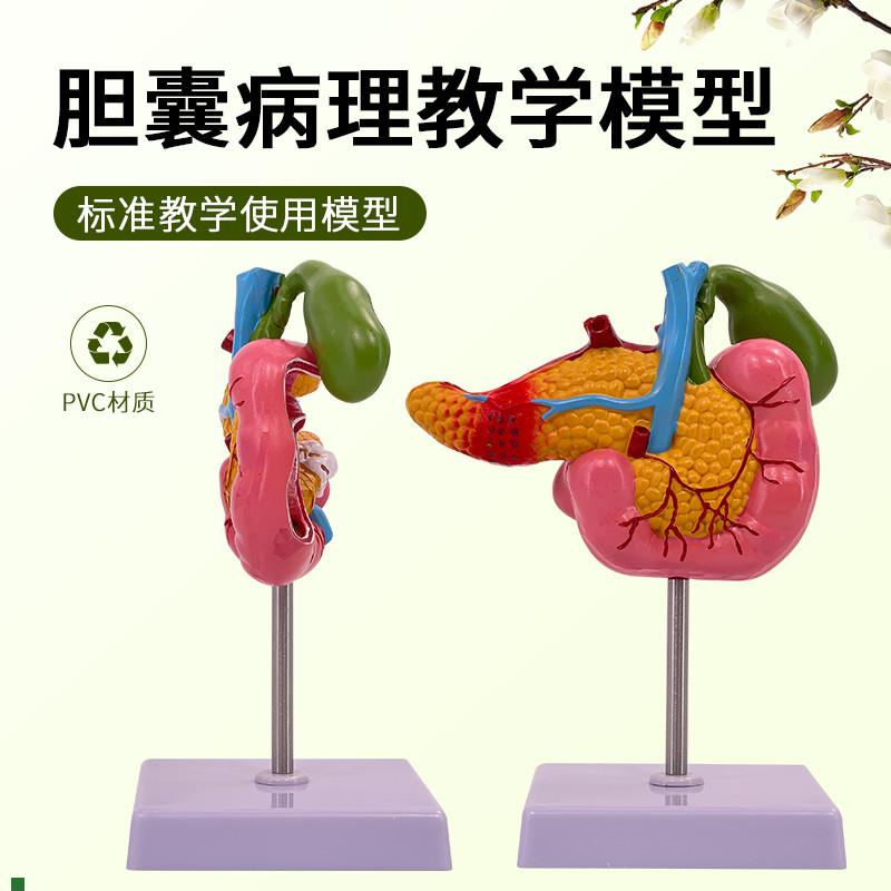 教学模型医学胰腺十二指肠胆囊B病理模型胆结石外科消化系统模型