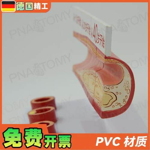 德国】人体血脂胆固醇与年龄模型guan心病血栓U过程模动脉医学