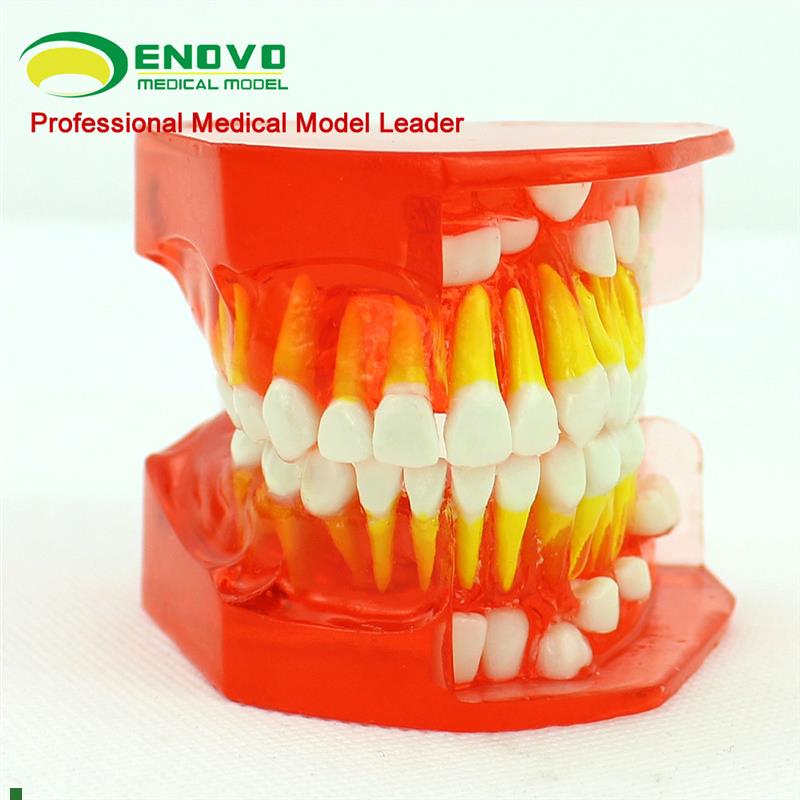 颐诺正品儿童乳牙发育牙列模型儿童口腔教学展示V牙科齿科模型