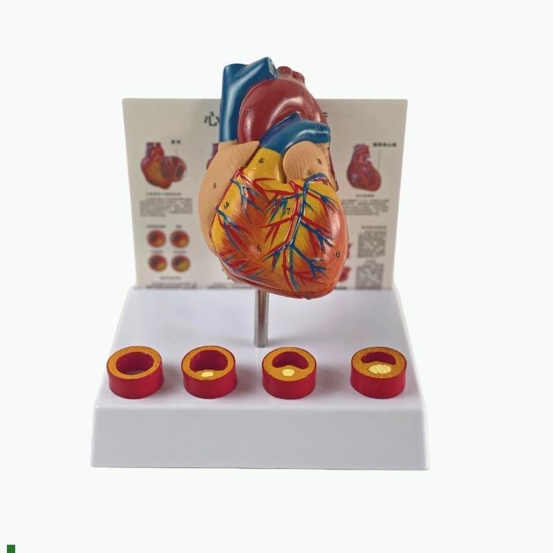 康泰模型心血管粥样硬化狭窄阻塞病理冠J状动脉临床医药促销人体