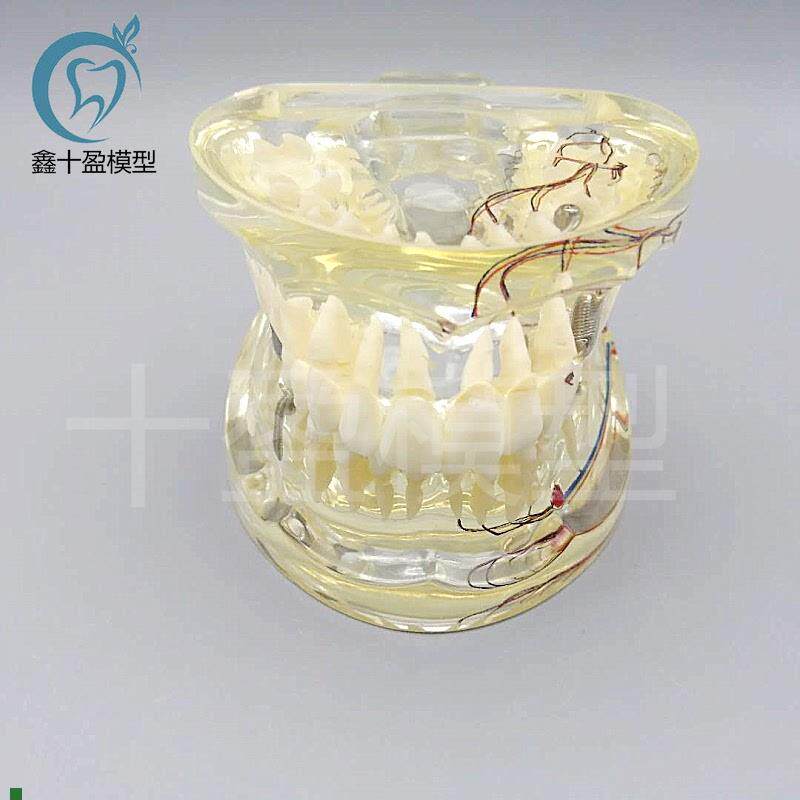牙科水晶牙齿病理模型M401v9-2成人透明病理牙模型带牙神经和嵌体