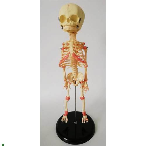 婴儿活动单头骷髅模型畸形幼儿z骨骼骨架人骨模型素描人体教学医