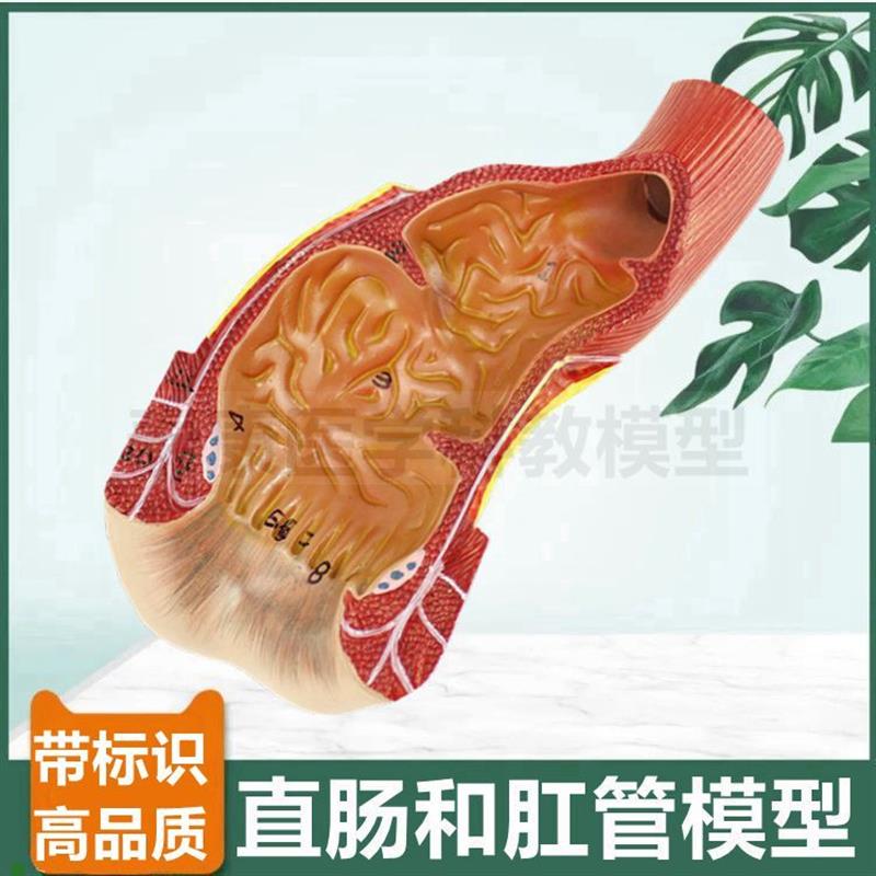 直肠模型肛管肛i周末端肛肠医生用痔疮回肠盲肠阑尾大小肠病理结