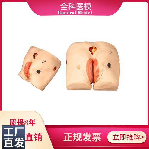 高级压疮(褥疮)护理模型操作练习训练P医学教学臀部模型