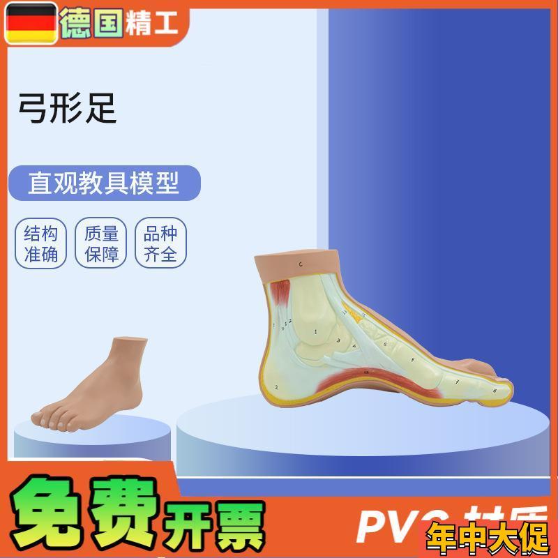 德国】PNT-07m27弓形足模型足部病理模型人体足部解剖模型脚关