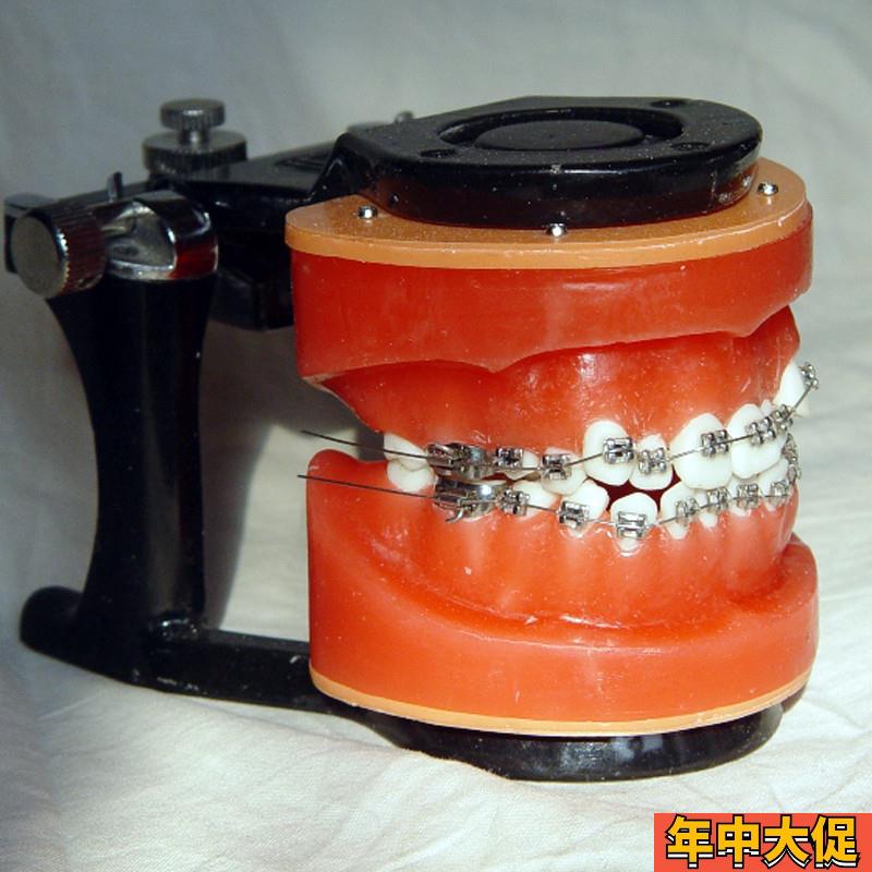 ENOVO颐诺正畸O矫正练习模型