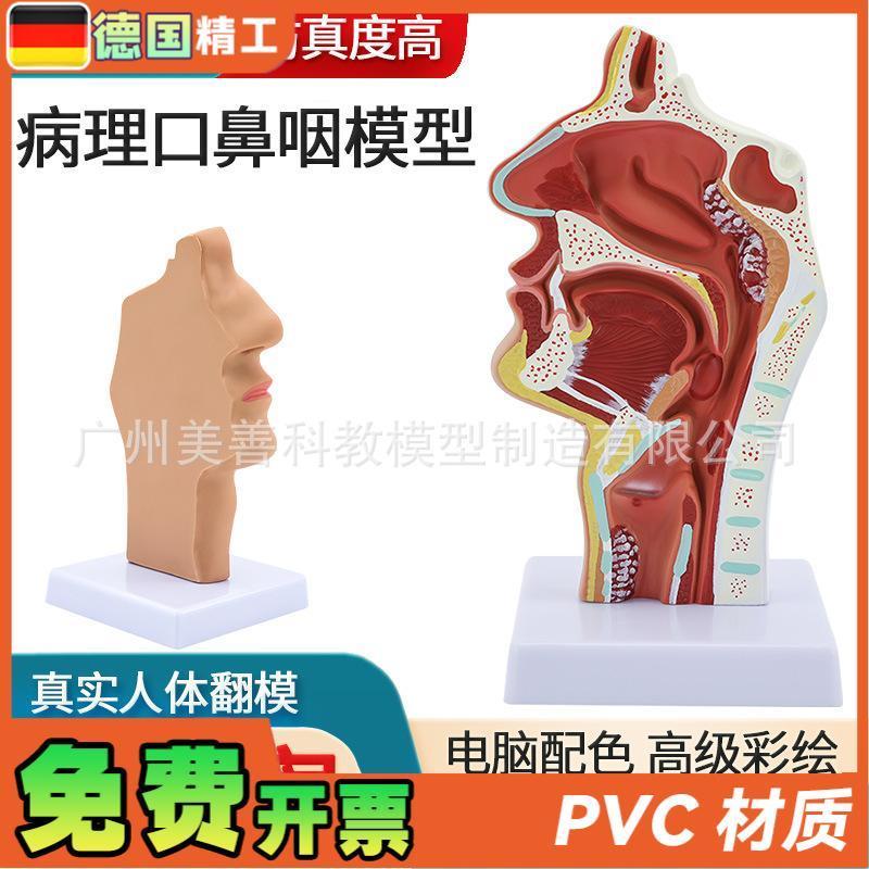 病理鼻腔解剖模型耳鼻喉科教学模型M鼻腔鼻子口鼻结构模型