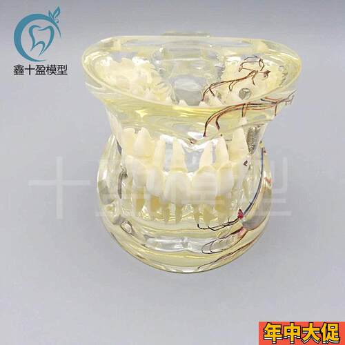 牙科水晶牙齿病理模型M4019-2B成人透明病理牙模型带牙神经和嵌体