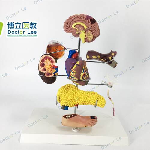 人体医学糖尿病模型s并发症大脑心脏胰腺神经元足内外科